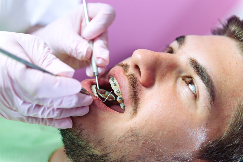 Adults Orthodontics Pomona, Adult Braces | Kool Kidz Orthodontics