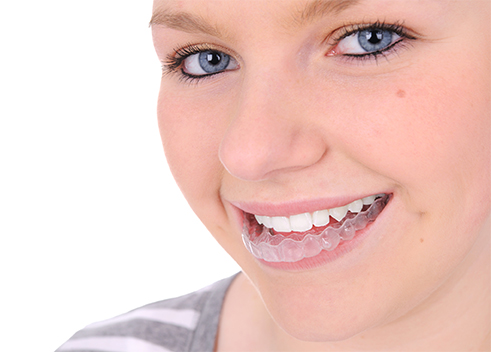 invisalign teen in pomona